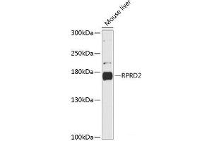 Western blot analysis of extracts of Mouse liver using RPRD2 Polyclonal Antibody at dilution of 1:3000. (RPRD2 anticorps)