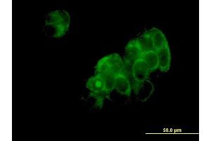 Immunofluorescence of monoclonal antibody to DNPEP on MCF-7 cell.