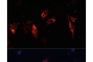 Immunofluorescence analysis of C6 cells using CTSL Polyclonal Antibody at dilution of 1:100.