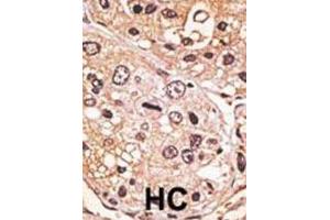 Immunohistochemistry (IHC) image for anti-Growth Differentiation Factor 9 (GDF9) antibody (ABIN3001444) (GDF9 anticorps)