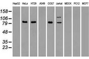 Western blot analysis of extracts (35 µg) from 9 different cell lines by using anti-anti-BRAFmonoclonal antibody. (BRAF anticorps)