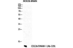 Western Blot (WB) analysis of Mouse Brain cells using DNAM-1 Polyclonal Antibody.