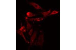 ABIN6275481 staining NIH-3T3 cells by IF/ICC.