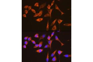 Immunofluorescence analysis of HeLa cells using G3BP11 Rabbit mAb (ABIN1683144, ABIN7101598, ABIN7101599 and ABIN7101600) at dilution of 1:100 (40x lens).