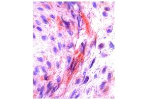 CSF1 in human placenta was detected using HRP/AEC red color stain.