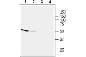Western blot analysis of rat colon (lanes 1 and 3) and pancreas (lanes 2 and 4) lysates: - 1,2 Anti-GPR39 (extracellular) Antibody (ABIN7043159, ABIN7044429 and ABIN7044430), (1:200).
