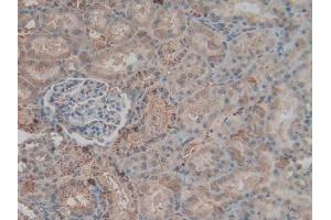 Detection of F2 in Rat Kidney Tissue using Polyclonal Antibody to Coagulation Factor II (F2)