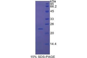 SDS-PAGE analysis of Mouse Interferon alpha 7 Protein.