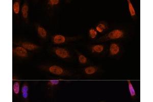 Immunofluorescence analysis of U-2 OS cells using THRB Polyclonal Antibody at dilution of 1:100. (THRB anticorps)
