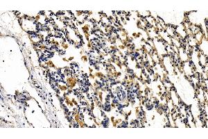 Detection of IRAK2 in Rat Lung Tissue using Polyclonal Antibody to Interleukin 1 Receptor Associated Kinase 2 (IRAK2) (IRAK2 anticorps  (AA 211-458))