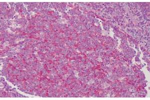 Human Tonsil: Formalin-Fixed, Paraffin-Embedded (FFPE) (TM7 anticorps)