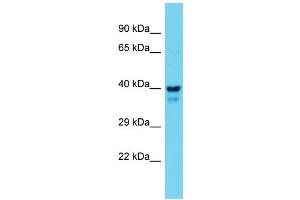 Western Blotting (WB) image for anti-Mitogen-Activated Protein Kinase Kinase 1 (MAP2K1) (N-Term) antibody (ABIN2788667) (MEK1 anticorps  (N-Term))