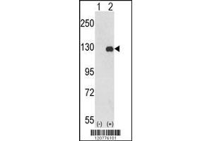 Western blot analysis of PTK2 using rabbit polyclonal PTK2 Antibody using 293 cell lysates (2 ug/lane) either nontransfected (Lane 1) or transiently transfected with the PTK2 gene (Lane 2). (FAK anticorps  (C-Term))