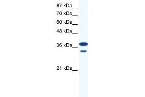WB Suggested Anti-LHX3 Antibody Titration:  0. (LHX3 anticorps  (Middle Region))