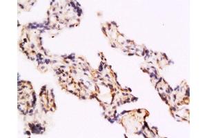 Formalin-fixed and paraffin embedded human placenta labeled with Rabbit Anti TLR4/CD284 Polyclonal Antibody, Unconjugated  at 1:200 followed by conjugation to the secondary antibody and DAB staining
