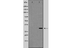 Western blot analysis of Interleukin 1β expression in HeLa cell lysate,The lane on the left is treated with the antigen-specific peptide. (IL-1 beta anticorps  (Internal Region))