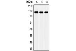 Western blot analysis of Apolipoprotein E Receptor 2 expression in MCF7 (A), NIH3T3 (B), H9C2 (C) whole cell lysates. (LRP8 anticorps  (Center))