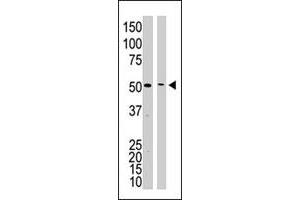 The PSEN1 polyclonal antibody  is used in Western blot to detect PSEN1 in mouse kidney tissue lysate (lane 1) and HL-60 cell lysate (lane 2) lysate. (Presenilin 1 anticorps  (C-Term))