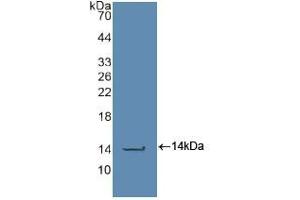 Western blot analysis of recombinant Human CASP2. (Caspase 2 anticorps  (AA 334-452))