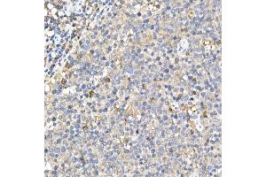 Immunohistochemistry of paraffin-embedded rat stomach using Phospho--S473 Rabbit mAb (ABIN6135179, ABIN6135970, ABIN6135971 and ABIN7101880) at dilution of 1:100 (40x lens). (AKT1 anticorps  (pSer473))