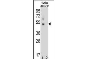 Western blot analysis of DNAJB6 Antibody (Center) Pab (ABIN656424 and ABIN2845716) pre-incubated without(lane 1) and with(lane 2) blocking peptide in Hela cell line lysate. (DNAJB6 anticorps  (AA 218-247))