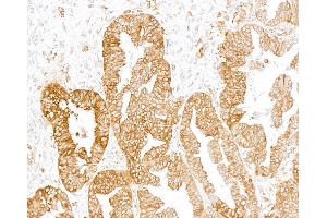 Immunohistochemistry (IHC) image for anti-Transmembrane Protein 173 (TMEM173) (C-Term) antibody (ABIN7795819) (Recombinant STING/TMEM173 anticorps  (C-Term))