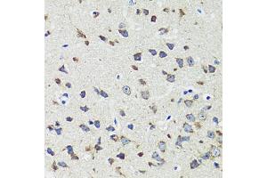 Immunohistochemistry of paraffin-embedded mouse brain using CCDC124 antibody  at dilution of 1:100 (40x lens). (CCDC124 anticorps  (AA 1-223))