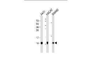 All lanes : Anti-S100A2 Antibody at 1:4000 dilution Lane 1: A431 whole cell lysate Lane 2: HACAT whole cell lysate Lane 3: S whole cell lysate Lysates/proteins at 20 μg per lane. (S100A2 anticorps)