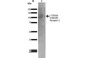 Western Blot analysis of Rat Brain Membrane showing detection of ~105 kDa GABA B Receptor 2 protein using Mouse Anti-GABA B Receptor 2 Monoclonal Antibody, Clone S81-2 . (GABBR2 anticorps  (AA 861-912) (FITC))