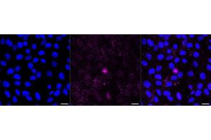 Immunocytochemical staining of H9c2 cells with Haptoglobin antibody (ABIN7798837), 1:1,000).
