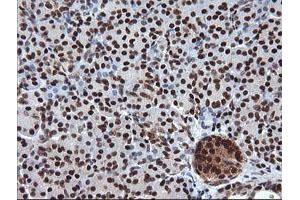 Image no. 3 for anti-Tripartite Motif Containing 38 (TRIM38) (AA 1-265) antibody (ABIN1490681) (TRIM38 anticorps  (AA 1-265))