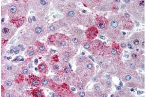 Human Liver (formalin-fixed, paraffin-embedded) stained with CCR10 antibody ABIN291274 at 5 ug/ml followed by biotinylated goat anti-rabbit IgG secondary antibody ABIN481713, alkaline phosphatase-streptavidin and chromogen. (CCR10 anticorps  (AA 350-362))