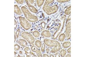 Immunohistochemistry of paraffin-embedded mouse kidney using METTL4 Rabbit pAb (ABIN6133091, ABIN6143773, ABIN6143774 and ABIN6224964) at dilution of 1:100 (40x lens).
