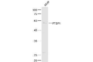 A549 lysates probed with PTBP1 Polyclonal Antibody, Unconjugated  at 1:500 dilution and 4˚C overnight incubation.