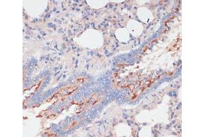 Immunohistochemistry of paraffin-embedded Rat lung using ZNRF3 Polyclonal Antibody at dilution of 1:100 (40x lens). (ZNRF3 anticorps)