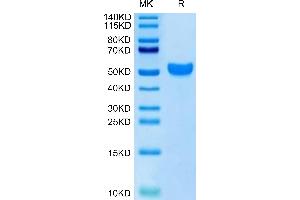 Human NKG2C on Tris-Bis PAGE under reduced condition.