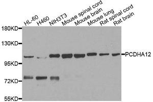 Western blot analysis of extracts of various cells, using PCDHA12 antibody. (PCDHA12 anticorps)