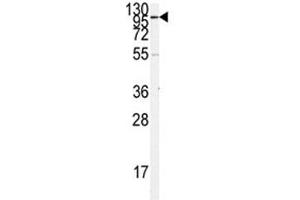 Western blot analysis of ACE2 antibody and K562 lysate.