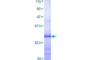Image no. 1 for Potassium Large Conductance Calcium-Activated Channel, Subfamily M, beta Member 1 (KCNMB1) (AA 39-130) protein (GST tag) (ABIN1308464)