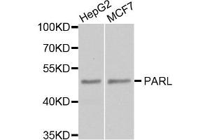 Western blot analysis of extract of HepG2 and MCF7 cells, using PARL antibody. (PARL anticorps)