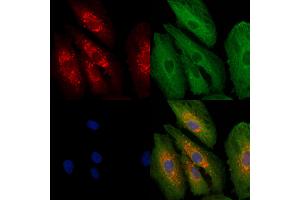 ABIN6262019 and ABIN6279471 staining  cells by IF/ICC.