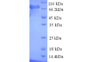 SDS-PAGE (SDS) image for Poly A Specific Ribonuclease (PARN) (AA 1-639), (full length) protein (His tag) (ABIN5713712)