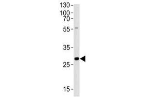 Western blot analysis of lysate from rat liver tissue lysate using Olig3 antibody at 1:1000.