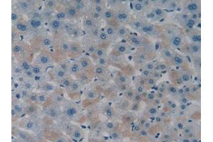 IHC-P analysis of Human Liver Tissue, with DAB staining. (ITFG1 anticorps  (AA 55-306))