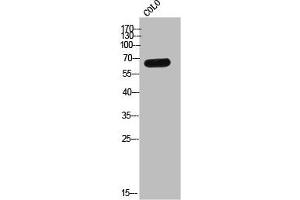 Western Blot analysis of COLO cells using Eme1 Polyclonal Antibody (Crossover junction endonuclease EME1 (EME1) (Internal Region) anticorps)