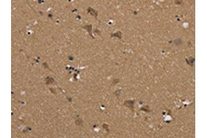 The image on the left is immunohistochemistry of paraffin-embedded Human brain tissue using ABIN7192079(PUS10 Antibody) at dilution 1/45, on the right is treated with synthetic peptide.