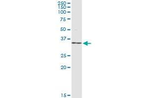 NR0B2 monoclonal antibody (M01), clone 1A11.