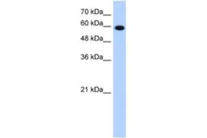 Western Blotting (WB) image for anti-Stress-Induced-phosphoprotein 1 (STIP1) antibody (ABIN2462951) (STIP1 anticorps)