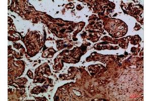 Immunohistochemical analysis of paraffin-embedded Human-placenta, antibody was diluted at 1:100 (NAIP anticorps  (AA 1191-1240))