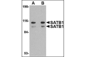 Western blot analysis of SATB1 in SK-N-SH cell lysate with this product at (A) 1 and (B) 2 μg/ml. (SATB1 anticorps  (N-Term))